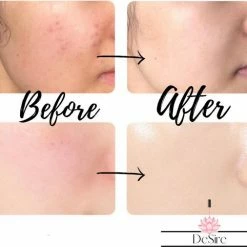 Desire Derma Roller - 540 Needle - 0.5 MM Naald - Steriel Verpakt - Skin Roller - Huid Verzorging - Huidverzorging - Dermaroller - Baardgroei Stimuleren - HaarGroei Stimulatie - Haar En Huid - Strakke Huid - Acné - Puisten - Striae - Littekens 13 Desire Derma Roller - 540 Needle - 0.5 MM Naald - Steriel Verpakt - Skin Roller - Huid Verzorging - Huidverzorging - Dermaroller - Baardgroei Stimuleren - HaarGroei Stimulatie - Haar En Huid - Strakke Huid - Acné - Puisten - Striae - Littekens -Givenchy-winkel 550x506 8