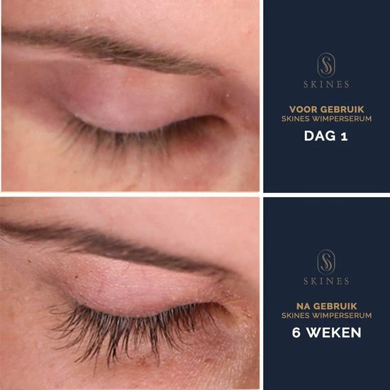 Skines Wimperserum Wimper Groei & Wimperlifting Vegan - Lange En Volle Wimpers 3ML 4 Skines Wimperserum Wimper Groei & Wimperlifting Vegan - Lange En Volle Wimpers 3ML - Afbeelding 4
