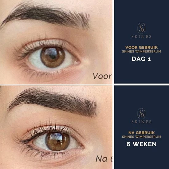 Skines Wimperserum Wimper Groei & Wimperlifting Vegan - Lange En Volle Wimpers 3ML 5 Skines Wimperserum Wimper Groei & Wimperlifting Vegan - Lange En Volle Wimpers 3ML - Afbeelding 5