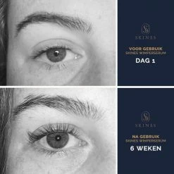 Skines Wimperserum Wimper Groei & Wimperlifting Vegan - Lange En Volle Wimpers 3ML 14 Skines Wimperserum Wimper Groei & Wimperlifting Vegan - Lange En Volle Wimpers 3ML -Givenchy-winkel 550x550 680