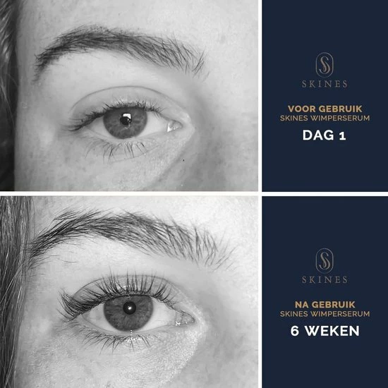 Skines Wimperserum Wimper Groei & Wimperlifting Vegan - Lange En Volle Wimpers 3ML 6 Skines Wimperserum Wimper Groei & Wimperlifting Vegan - Lange En Volle Wimpers 3ML - Afbeelding 6