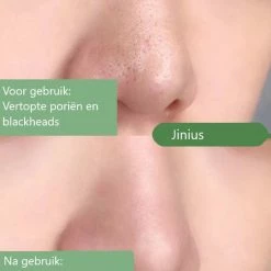 Jinius Green Mask Stick Green Tea Stick Gezichtsmasker Gezichtsverzorging - Mee-eters Verwijderen Acne Verwijderen Natuurlijk Product 7 Jinius Green Mask Stick Green Tea Stick Gezichtsmasker Gezichtsverzorging - Mee-eters Verwijderen Acne Verwijderen Natuurlijk Product -Givenchy-winkel 550x704 3
